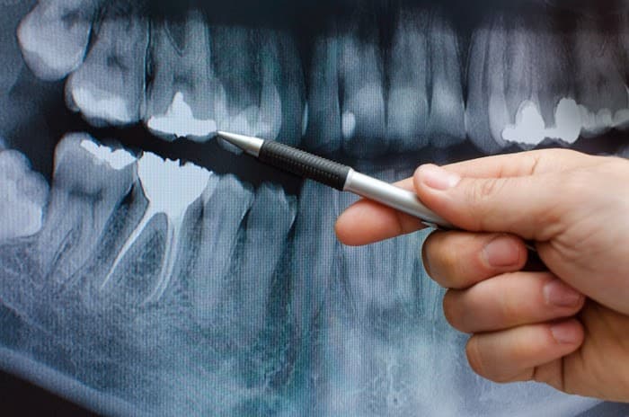 Nederland Smile Docs