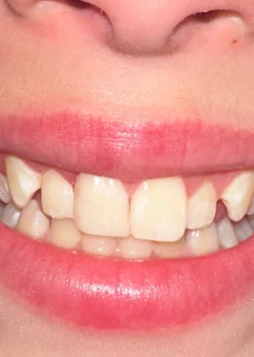 Cornerstone Dental
