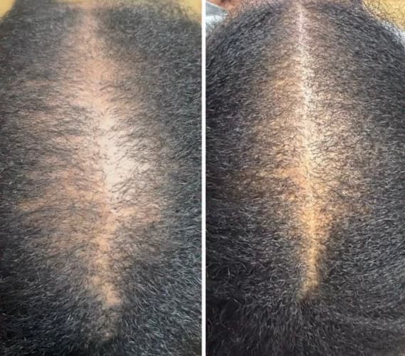 Roots And Follicle Holistic Hair Loss Clinic
